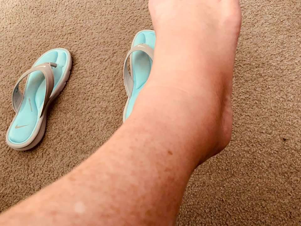 My ankle on Tuesday morning. It is still pretty big.