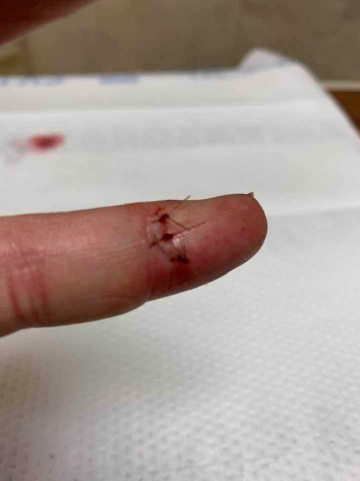 Nasty cut finger needed 3 stitches. No fall planting for this one today.