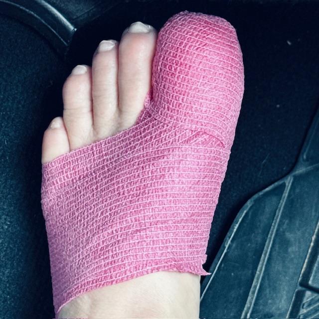She wrapped my foot very well once surgery was complete. Glad I did not wear tennis shoes or I would not have been able to get them back on.