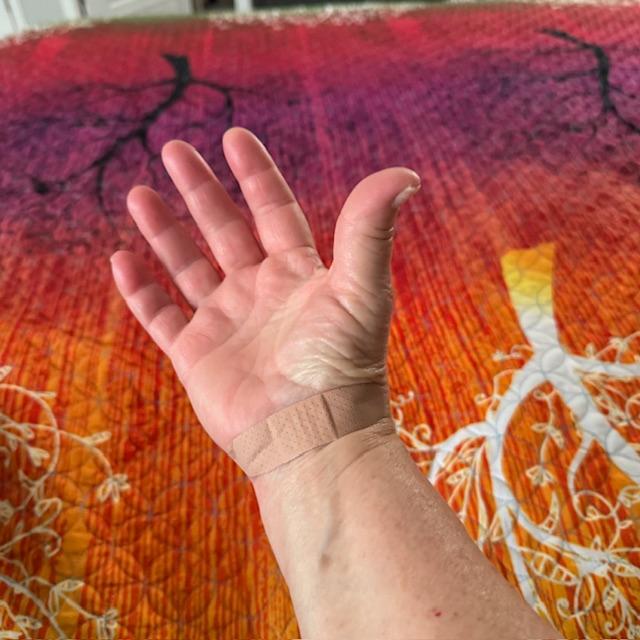 The bandaid shows where the injection was.