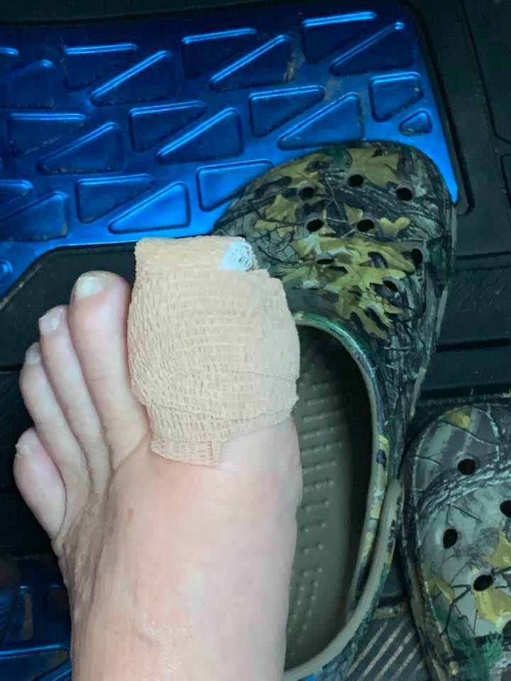 The podiatrist did some surgery on my toenail today. I won't be planting a fall vegetable garden this week, although David and Matt will.