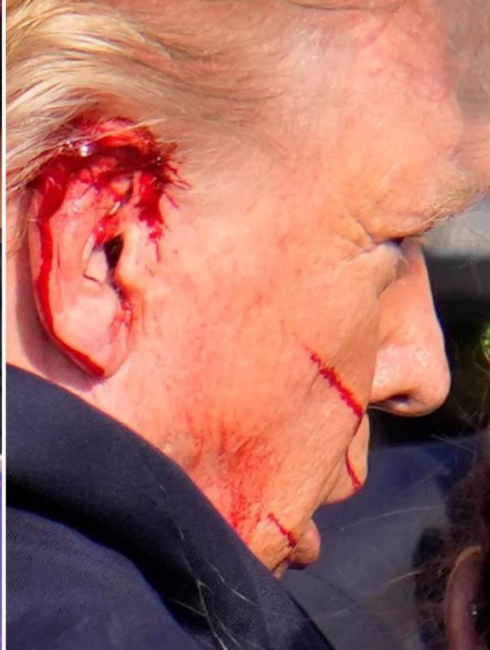 It is only by God's grace that President Trump is still alive. The election is now over. There is no doubt who will win.